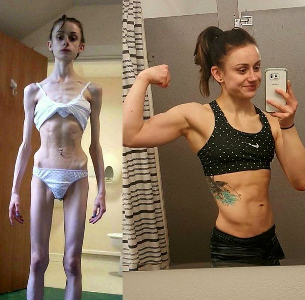  Девушка победила анорексию и стала бойцом MMA