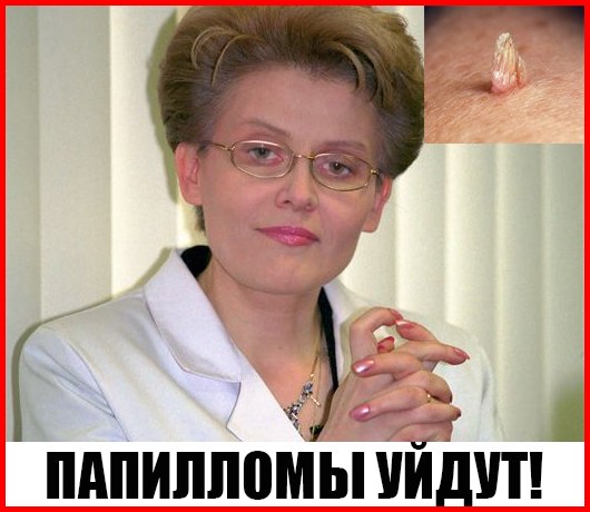 УМОЛЯЮ, не надо удалять ПАПИЛЛОМЫ!