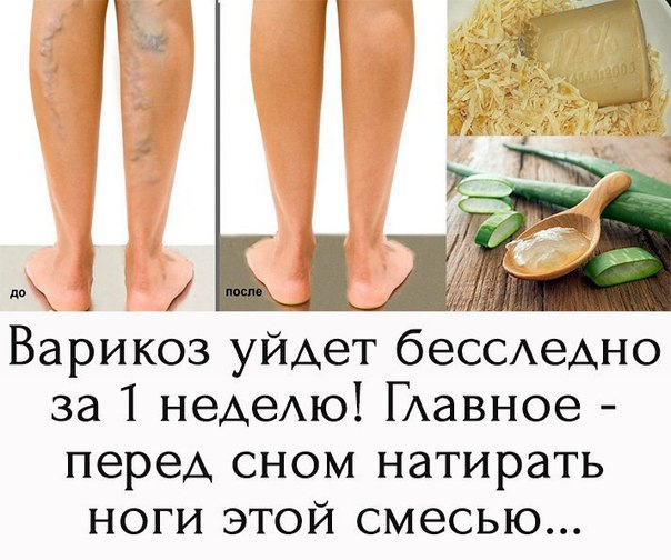 Натри им вены перед сном и ТРОМБЫ УЙДУТ!