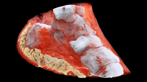Первый в истории цветной рентгеновский снимок , сделанный с помощью адронного коллайдера